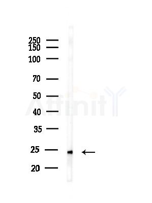 NRIP2 Antibody - Western blot analysis of lysates from Mouse testis, using NRIP2 Antibody at 1/1000 dilution.