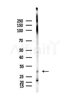 COX11 Antibody - Western blot analysis of lysates from Raji cells(heat-shock,45min treatment), using COX11 Antibody at 1/1000 dilution.