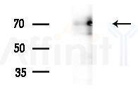 FOXJ3 Antibody - Western blot analysis of extracts from B16F10-HUC(heat-shock treatment), using FOXJ3 Antibody at 1/1000 dilution.