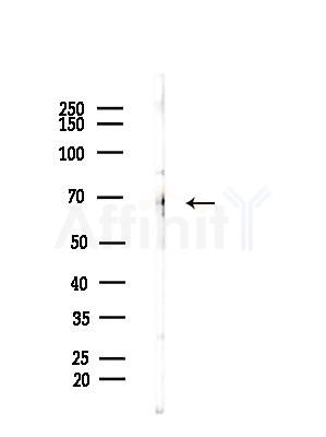 FOXJ3 Antibody - Western blot analysis of lysates from B16F10-HUC(heat-shock treatment), using FOXJ3 Antibody at 1/1000 dilution.