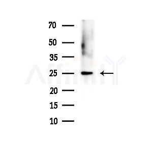 AKAP14 Antibody - Western blot analysis of extracts from PC12 cells(LPS,4h treatment), using AKAP14 Antibody at 1/1000 dilution.