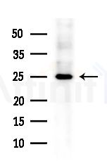 AKAP14 Antibody - Western blot analysis of extracts from HepG2 cells(heat-shock treatment), using AKAP14 Antibody at 1/1000 dilution.