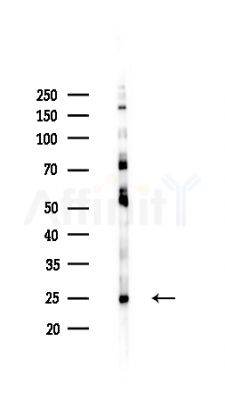 AKAP14 Antibody - Western blot analysis of lysates from HepG2 cells(heat-shock,45min treatment), using AKAP14 Antibody at 1/1000 dilution.