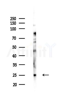 AKAP14 Antibody - Western blot analysis of lysates from PC12 cells(LPS,4h treatment), using AKAP14 Antibody at 1/1000 dilution.