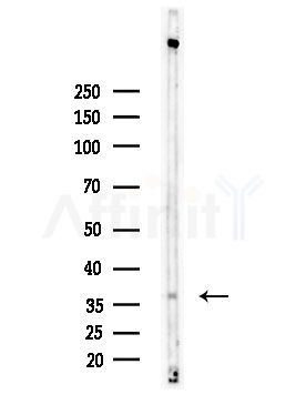ELOVL4 Antibody - Western blot analysis of lysates from Rat brain, using ELOVL4 Antibody at 1/1000 dilution.