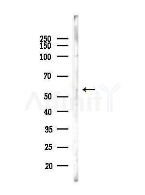 UBXD5 Antibody - Western blot analysis of lysates from LoVo cells(heat-shock,45min treatment), using UBXD5 Antibody at 1/1000 dilution.