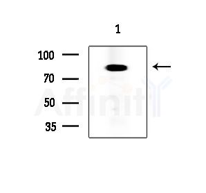 DYR1B Antibody - Western blot analysis of extracts from EC304 cells, using DYR1B Antibody at 1/1000 dilution.