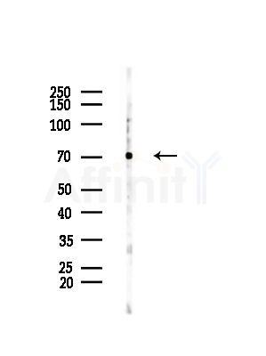 DYR1B Antibody - Western blot analysis of lysates from EC304 cells, using DYR1B Antibody at 1/1000 dilution.