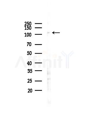 CDK11 Antibody - Western blot analysis of lysates from COLO205 cells(UV,30min treatment), using CDK11 Antibody at 1/1000 dilution.