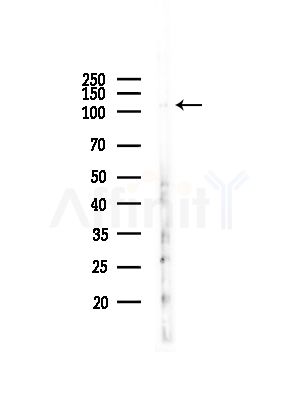 CDK11 Antibody - Western blot analysis of lysates from Hela cells(heat-shock,45min treatment), using CDK11 Antibody at 1/1000 dilution.