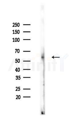 Smad1/5/9 Antibody - Western blot analysis of lysates from Hela cells(heat-shock,45min treatment), using Smad1/5/9 Antibody at 1/1000 dilution.