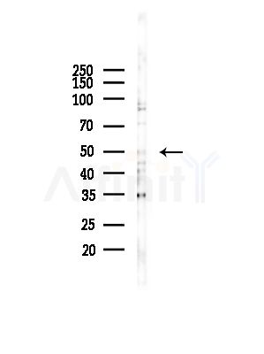 PFKFB1/4 Antibody - Western blot analysis of lysates from COLO205 cells(UV,30min treatment), using PFKFB1/4 Antibody at 1/1000 dilution.