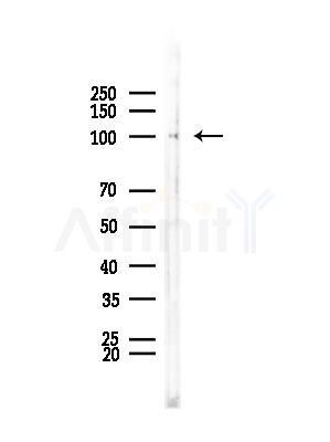 HSP105 Antibody - Western blot analysis of lysates from COLO205 cells, using HSP105 Antibody at 1/1000 dilution.