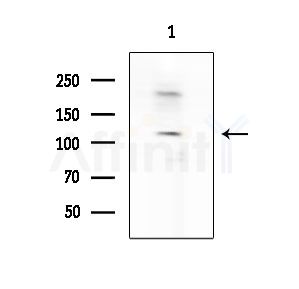 EPHA7 Antibody - Western blot analysis of extracts from Hela cells(heat-shock treatment), using EPHA7 Antibody at 1/1000 dilution.