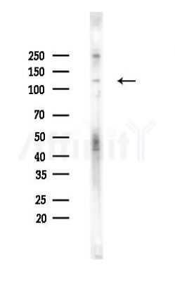 EPHA7 Antibody - Western blot analysis of lysates from Hela cells(heat-shock,45min treatment), using EPHA7 Antibody at 1/1000 dilution.