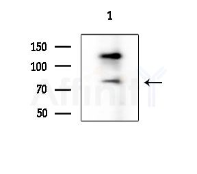 CCDC99 Antibody - Western blot analysis of extracts from A375 cells(starvation treatment), using CCDC99 Antibody at 1/1000 dilution.