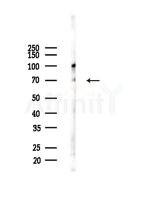 CCDC99 Antibody - Western blot analysis of lysates from A375 cells(starvation,24h treatment), using CCDC99 Antibody at 1/1000 dilution.