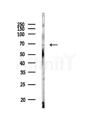IF3EI Antibody - Western blot analysis of lysates from HUVEC cells(heat-shock, 45min treatment), using IF3EI Antibody at 1/1000 dilution.