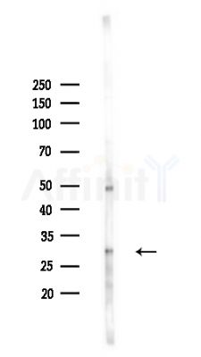 HOXD12 Antibody - Western blot analysis of lysates from HepG2 cells(heat-shock,45min treatment), using HOXD12 Antibody at 1/1000 dilution.