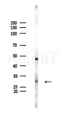 HOXD12 Antibody - Western blot analysis of lysates from Rat brain, using HOXD12 Antibody at 1/1000 dilution.