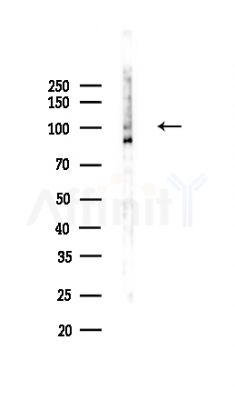TM16G Antibody - Western blot analysis of lysates from COLO205 cells(UV,30min treatment), using TM16G Antibody at 1/1000 dilution.