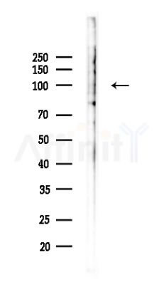 TM16G Antibody - Western blot analysis of lysates from HepG2 cells(LPS,4h treatment), using TM16G Antibody at 1/1000 dilution.