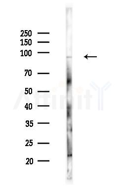AKAP2 Antibody - Western blot analysis of lysates from B16F10-LUC cells(heat-shock,45min treatment), using AKAP2 Antibody at 1/1000 dilution.