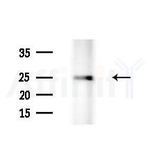 RNF144A Antibody - Western blot analysis of extracts from HepG2 cells(LPS, 4h treatment), using RNF144A Antibody at 1/1000 dilution.