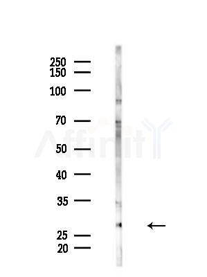 RNF144A Antibody - Western blot analysis of lysates from HepG2 cells(LPS, 4h treatment), using RNF144A Antibody at 1/1000 dilution.