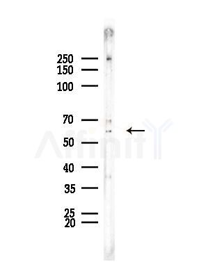 DAK Antibody - Western blot analysis of lysates from COLO205 cells, using DAK Antibody at 1/1000 dilution.