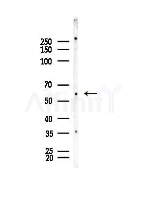DAK Antibody - Western blot analysis of lysates from EC304 cells, using DAK Antibody at 1/1000 dilution.