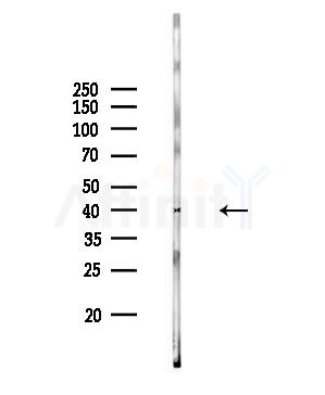 ELOVL1 Antibody - Western blot analysis of lysates from Rat brain, using ELOVL1 Antibody at 1/1000 dilution.