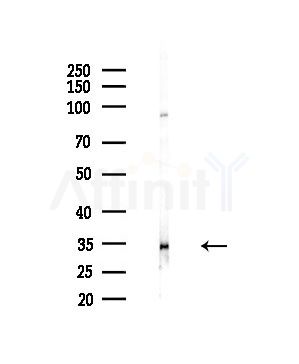 ELOVL1 Antibody - Western blot analysis of lysates from HepG2 cells(LPS,4h treatment), using ELOVL1 Antibody at 1/1000 dilution.