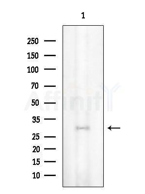 ANKRD1 Antibody - Western blot analysis of extracts from Rat testis, using ANKRD1 Antibody at 1/1000 dilution.