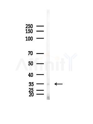 ANKRD1 Antibody - Western blot analysis of lysates from EC304 cells, using ANKRD1 Antibody at 1/1000 dilution.