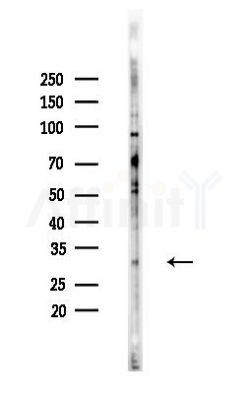 SURF1 Antibody - Western blot analysis of lysates from Hela cells(heat-shock,45min treatment), using SURF1 Antibody at 1/1000 dilution.