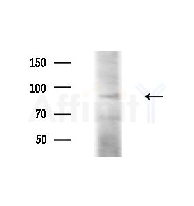 ZNF287 Antibody - Western blot analysis of lysates from COLO205 cells(heat-shock,45min treatment), using ZNF287 Antibody at 1/1000 dilution.