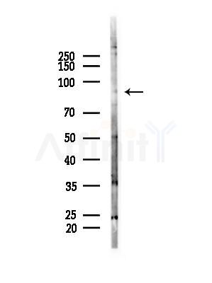 ZNF287 Antibody - Western blot analysis of lysates from COLO205 cells(heat-shock,45min treatment), using ZNF287 Antibody at 1/1000 dilution.