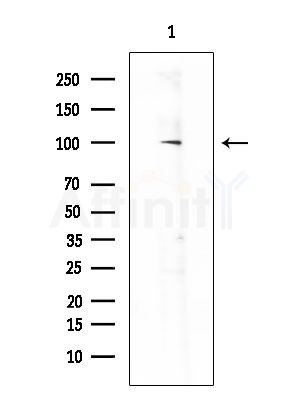 AAK1 Antibody - Western blot analysis of lysates from Rat brain, using AAK1 Antibody at 1/1000 dilution.