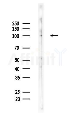 AAK1 Antibody - Western blot analysis of lysates from Rat brain, using AAK1 Antibody at 1/1000 dilution.