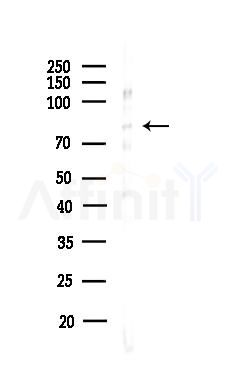 MARK4 Antibody - Western blot analysis of lysates from HepG2 cells(heat-shock,45min treatment), using MARK4 Antibody at 1/1000 dilution.