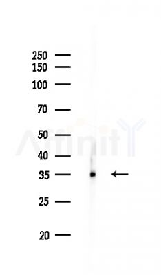 ALDOC Antibody - Western blot analysis of lysates from Rat brain, using ALDOC Antibody at 1/1000 dilution.