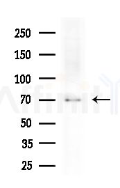 EPN1 Antibody - Western blot analysis of extracts from Rat brain, using EPN1 Antibody at 1/1000 dilution.