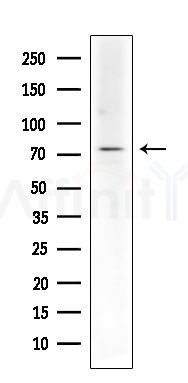 EPN1 Antibody - Western blot analysis of extracts from Mouse liver, using EPN1 Antibody at 1/1000 dilution.