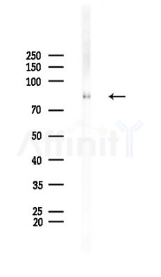 EPN1 Antibody - Western blot analysis of lysates from Rat brain, using EPN1 Antibody at 1/1000 dilution.