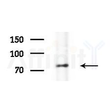 STON1 Antibody - Western blot analysis of lysates from HepG2 cells(starvation,24h treatment), using STON1 Antibody at 1/1000 dilution.