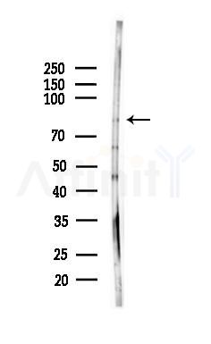 STON1 Antibody - Western blot analysis of lysates from HepG2 cells(starvation,24h treatment), using STON1 Antibody at 1/1000 dilution.
