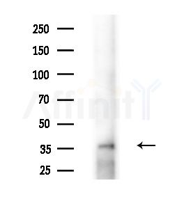FOXL1 Antibody - Western blot analysis of extracts from HUVEC cells(starvation,24h treatment), using FOXL1 Antibody at 1/1000 dilution.
