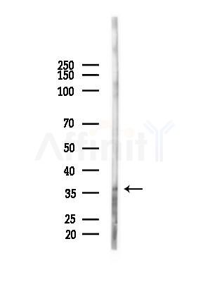 FOXL1 Antibody - Western blot analysis of lysates from HUVEC cells(starvation,24h treatment), using FOXL1 Antibody at 1/1000 dilution.