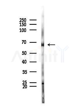 GAD1/2 Antibody - Western blot analysis of lysates from Rat brain, using GAD1/2 Antibody at 1/1000 dilution.